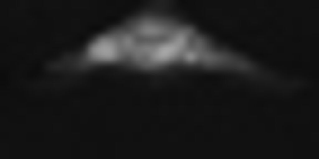 SD JERSEY LACE BACK DETAIL